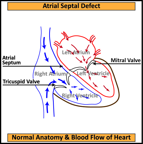 1-ASD-Normal-Anatomy