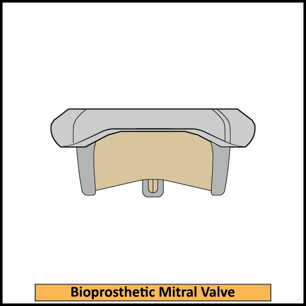 Bioprosthetic-Mitral-Valve