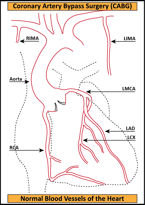 CABG-1-Normal-Blood-Vessels-of-the-Heart